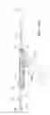 Fig. 37 - Endoscopic tissue anchor deployment