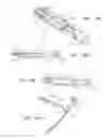 Fig. 50 - Endoscopic tissue anchor deployment