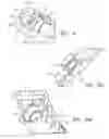 Fig. 56 - Endoscopic tissue anchor deployment