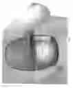 Fig. 06 - Supporting and Forming Transitional Material for Use in Supporting Prosthesis Devices, Implants and to Provide Structure in a Human Body