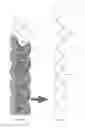 Fig. 10 - Supporting and Forming Transitional Material for Use in Supporting Prosthesis Devices, Implants and to Provide Structure in a Human Body