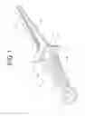 Fig. 02 - SURGICAL CLIP
