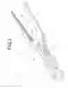 Fig. 03 - SURGICAL CLIP