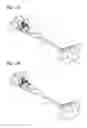 Fig. 02 - Vessel occlusive device and method of occluding a vessel