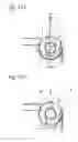 Fig. 10 - Vessel occlusive device and method of occluding a vessel