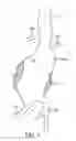 Fig. 02 - Methods and Systems for Treating Aneurysms