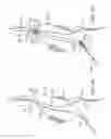 Fig. 05 - Methods and Systems for Treating Aneurysms