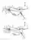 Fig. 06 - Methods and Systems for Treating Aneurysms