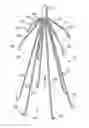 Fig. 01 - Removeable embolus blood clot filter and filter delivery unit