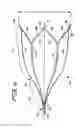 Fig. 05 - Vein filter