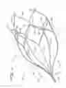 Fig. 07 - Vein filter