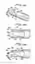 Fig. 19 - Vein filter