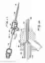 Fig. 24 - Vein filter