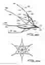 Fig. 26 - Vein filter