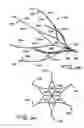 Fig. 34 - Vein filter