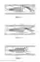 Fig. 03 - Vascular Implant Retrieval Method, Retrieval Assembly And Tool For Same