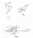 Fig. 05 - Latch mechanism for surgical instruments