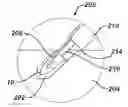 Fig. 01 - BIOABSORBABLE SUTURE ANCHOR SYSTEM FOR USE IN SMALL JOINTS