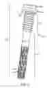 Fig. 04 - EXPANDABLE FACET SCREW