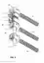 Fig. 07 - VERTEBRAL COLUMN IMPLANT