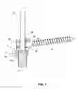 Fig. 08 - VERTEBRAL COLUMN IMPLANT