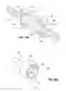 Fig. 11 - VERTEBRAL COLUMN IMPLANT