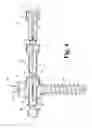 Fig. 04 - Linked spinal stabilization elements for spinal fixation
