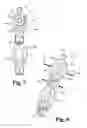 Fig. 06 - Linked spinal stabilization elements for spinal fixation