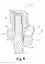 Fig. 07 - Linked spinal stabilization elements for spinal fixation