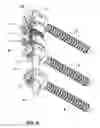 Fig. 07 - VERTEBRAL COLUMN IMPLANT