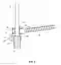 Fig. 08 - VERTEBRAL COLUMN IMPLANT