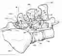 Fig. 01 - ARTIFICIAL FACET JOINT AND METHOD