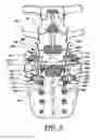 Fig. 05 - ARTIFICIAL FACET JOINT AND METHOD