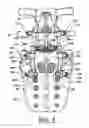 Fig. 07 - ARTIFICIAL FACET JOINT AND METHOD