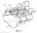 Fig. 08 - ARTIFICIAL FACET JOINT AND METHOD