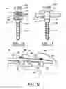 Fig. 09 - ARTIFICIAL FACET JOINT AND METHOD