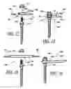 Fig. 11 - ARTIFICIAL FACET JOINT AND METHOD
