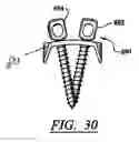 Fig. 15 - ARTIFICIAL FACET JOINT AND METHOD