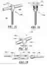 Fig. 16 - ARTIFICIAL FACET JOINT AND METHOD