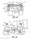 Fig. 17 - ARTIFICIAL FACET JOINT AND METHOD