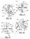 Fig. 20 - ARTIFICIAL FACET JOINT AND METHOD