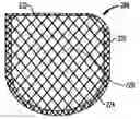 Fig. 01 - Anchorage devices comprising an active pharmaceutical ingredient
