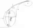 Fig. 01 - Heart stimulating device with selecting optimal electrode configuration