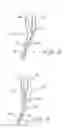 Fig. 09 - Indwelling heat exchange catheter and method of using same