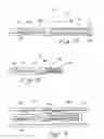 Fig. 11 - Indwelling heat exchange catheter and method of using same