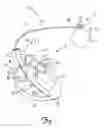 Fig. 02 - Implantable active fixation lead with biodegradable helical tip