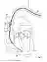 Fig. 02 - Self-dissolving electrode or probe implant