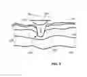Fig. 06 - Disposable electromagnetic energy applicator and method of using it
