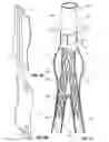 Fig. 04 - VASCULAR BAND