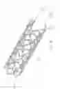 Fig. 12 - Flexible and expandable stent